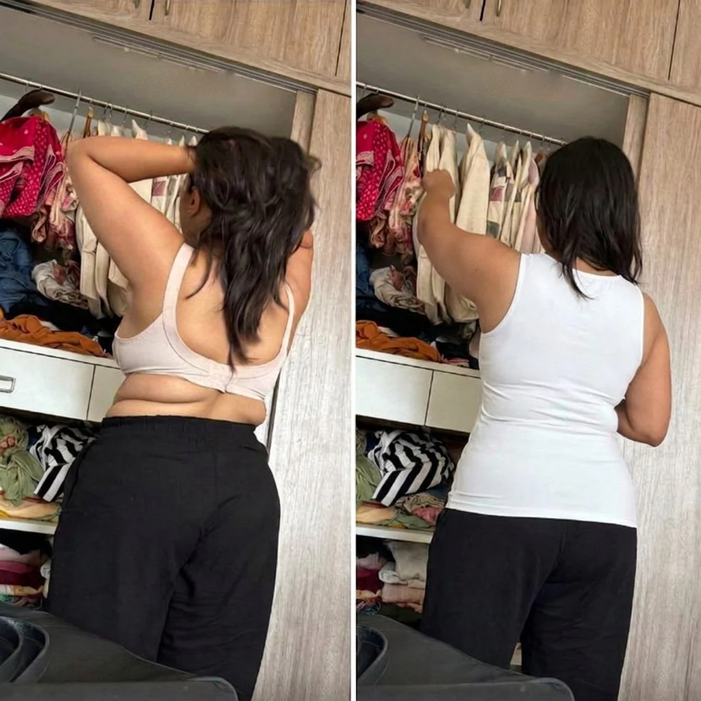 Before and after side profile comparison